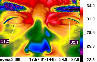 Facial thermal imaging - periorbital
                            region of eyes